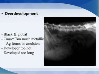 • Overdevelopment
- Black & global
- Cause: Too much metallic
Ag forms in emulsion
- Developer too hot
- Developed too long
 