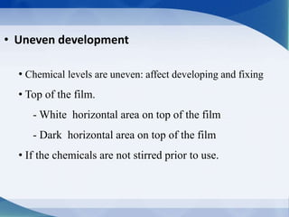 • Uneven development
• Chemical levels are uneven: affect developing and fixing
• Top of the film.
- White horizontal area on top of the film
- Dark horizontal area on top of the film
• If the chemicals are not stirred prior to use.
 