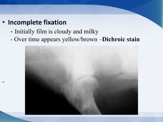 • Incomplete fixation
- Initially film is cloudy and milky
- Over time appears yellow/brown –Dichroic stain
-
 