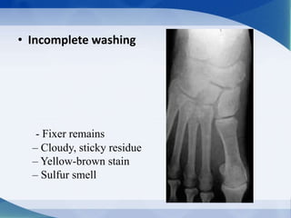 • Incomplete washing
- Fixer remains
– Cloudy, sticky residue
– Yellow-brown stain
– Sulfur smell
 