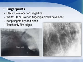 • Fingerprints
- Black: Developer on fingertips
- White: Oil or Fixer on fingertips blocks developer
- Keep fingers dry and clean
- Touch only film edges
 