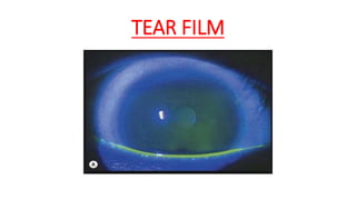 TEAR FILM
 