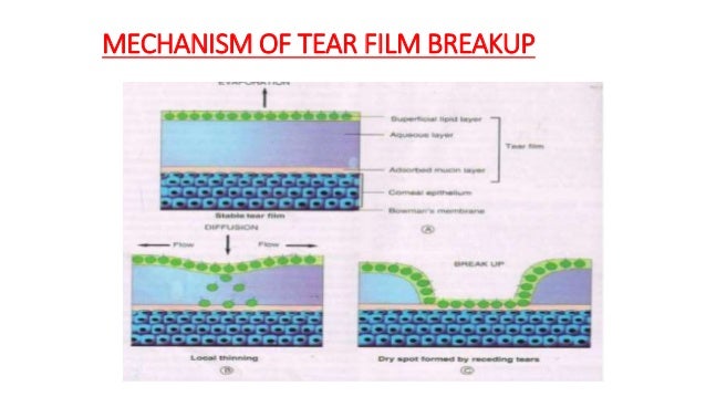 Dr. r.subramaniyan, 08 3-17 tear film