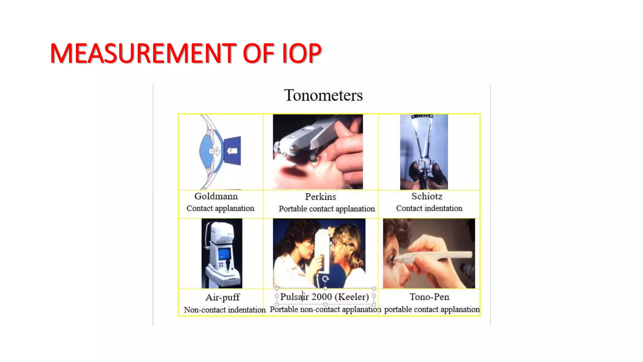 MEASUREMENT OF IOP
 