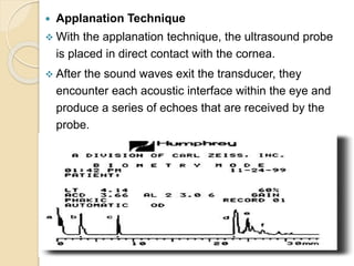  Applanation Technique
 With the applanation technique, the ultrasound probe
is placed in direct contact with the cornea.
 After the sound waves exit the transducer, they
encounter each acoustic interface within the eye and
produce a series of echoes that are received by the
probe.
 
