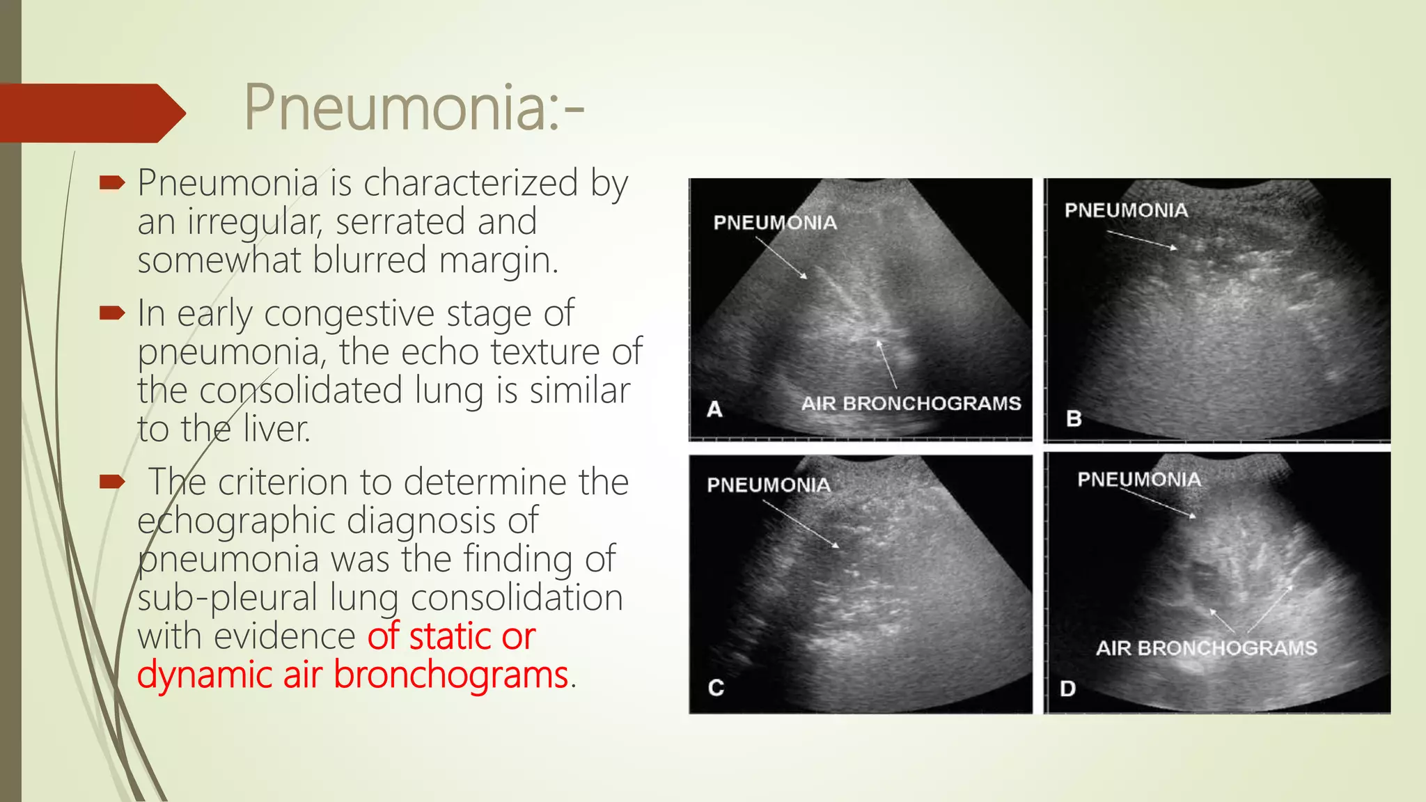 Lung Ultrasound Basics | PPTX