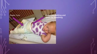 Abdomial padding and
space for breathing
Diaper Care
 