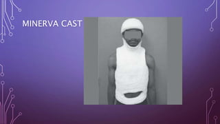 MINERVA CAST
 