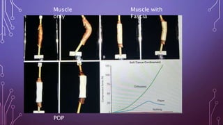 Muscle
only
Muscle with
Fascia
POP
 