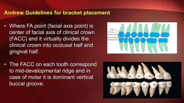 Bracket positioning | PPTX | Dental Health | Diseases and Conditions