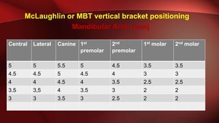 Bracket positioning | PPTX