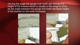 Bracket Height Bracket positioning | PPTX