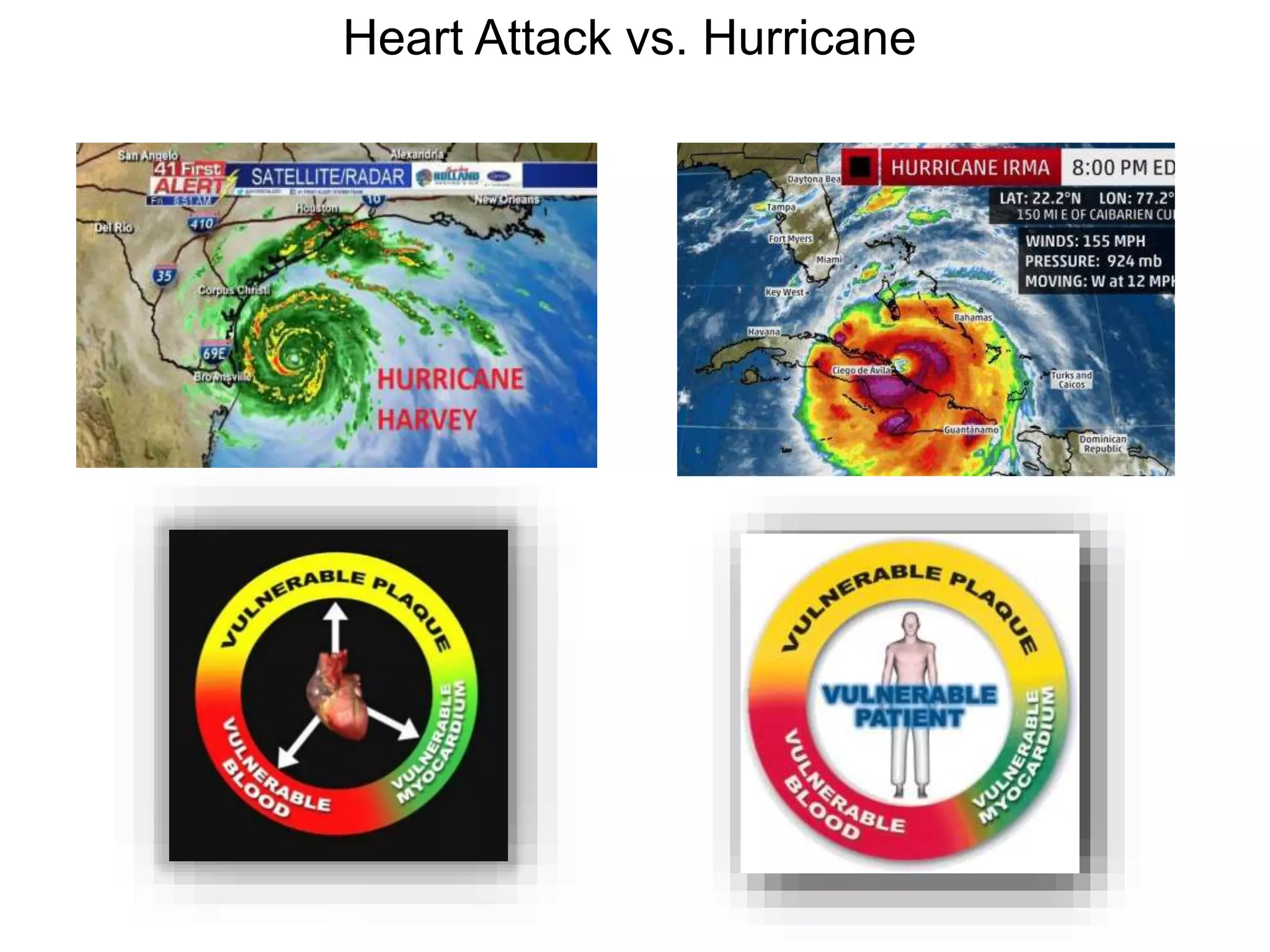 Heart Attack vs. Hurricane
 