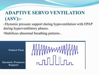 Asv Epap OSA & COPD (OVERLAP SYNDROME) | PPTX