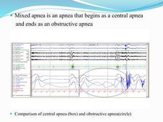 Mixed Apnea Example OSA & COPD (OVERLAP SYNDROME) | PPTX