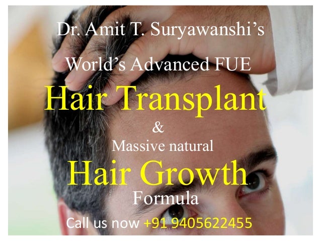 World S Advanced Hair Transplant Hair Growth Formula Call Us Now