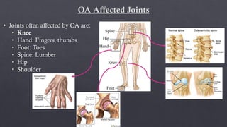 Osteoarthritis | PDF