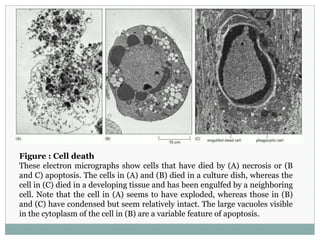 Figure : Cell death
These electron micrographs show cells that have died by (A) necrosis or (B
and C) apoptosis. The cells in (A) and (B) died in a culture dish, whereas the
cell in (C) died in a developing tissue and has been engulfed by a neighboring
cell. Note that the cell in (A) seems to have exploded, whereas those in (B)
and (C) have condensed but seem relatively intact. The large vacuoles visible
in the cytoplasm of the cell in (B) are a variable feature of apoptosis.
 