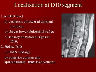 localization spinal cord | PPTX