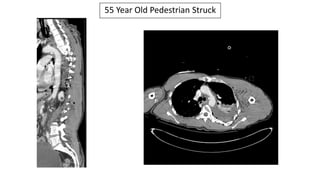 55 Year Old Pedestrian Struck
 