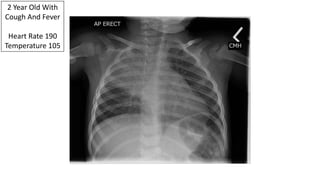 2 Year Old With
Cough And Fever
Heart Rate 190
Temperature 105
 