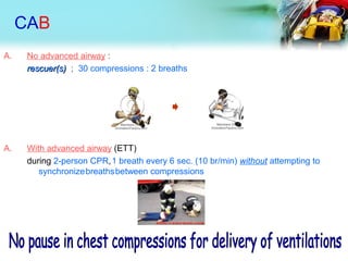 CAB
A. No advanced airway :
rescuer(s)rescuer(s) ; 30 compressions : 2 breaths
A. With advanced airway (ETT)
during 2-person CPR,1 breath every 6 sec. (10 br/min) without attempting to
synchronizebreathsbetween compressions
 