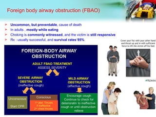 Foreign body airway obstruction (FBAO)
 Uncommon, but preventable, cause of death
 In adults , mostly while eating
 Choking is commonly witnessed, and the victim is still responsive
 Rx : usually successful, and survival rates˃95%
1st
abd. Thrusts
if ineffective
2nd
chest thrusts
 