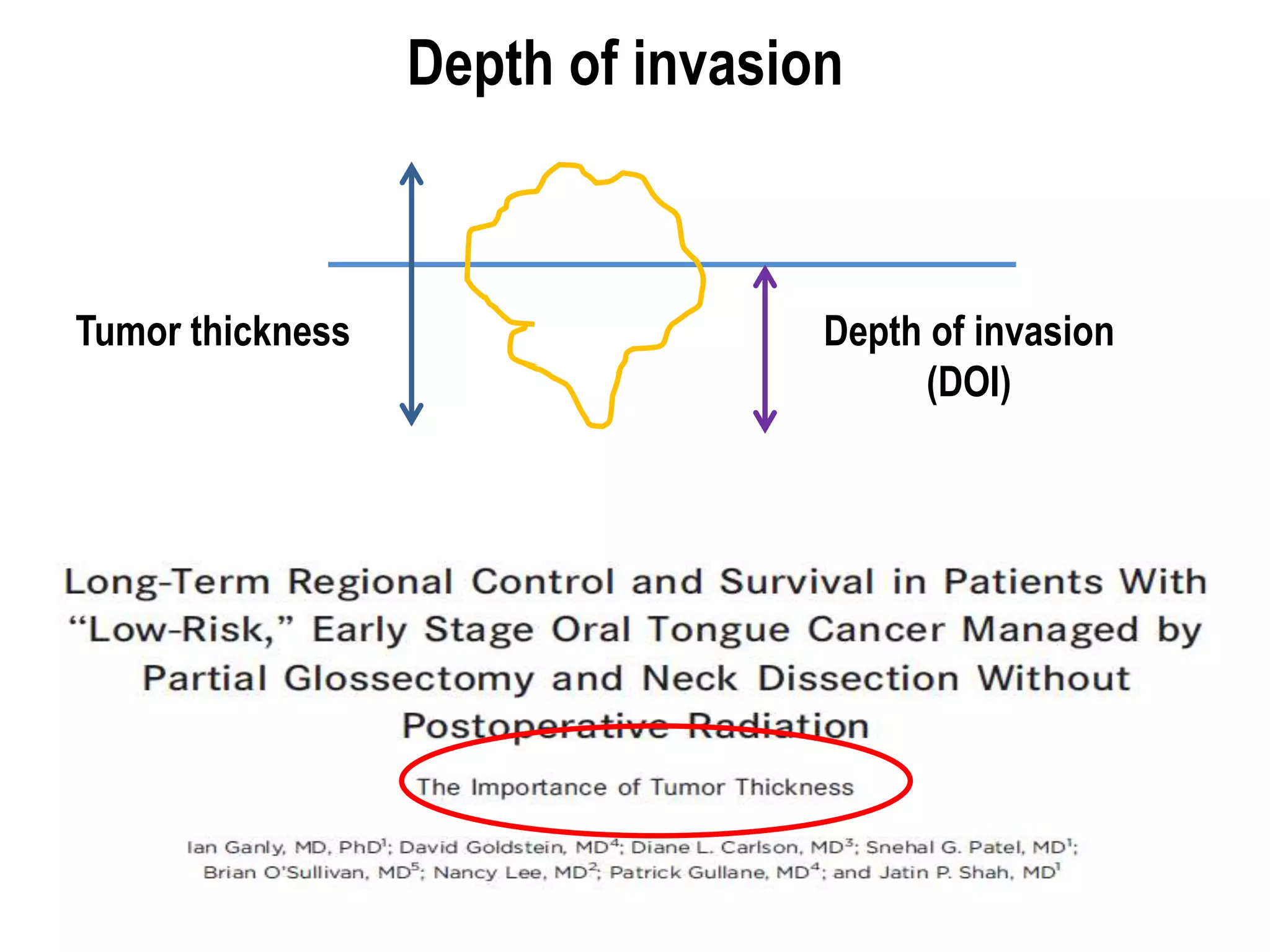 Role of Post-op Radiotherapy in Head and Neck Cancers | PPTX