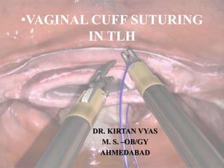 •VAGINAL CUFF SUTURING
IN TLH
DR. KIRTAN VYAS
M. S. –OB/GY
AHMEDABAD
 
