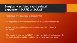 Orthognathic Surgical Procedure on non-growing patients with maxillary ...
