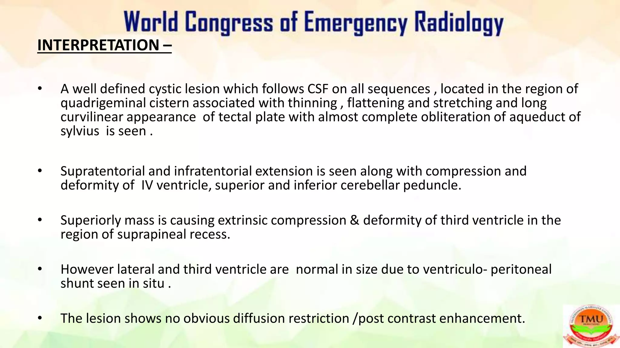 TECTAL PLATE CYST : AN UNUSUAL PRESENTATION | PPTX