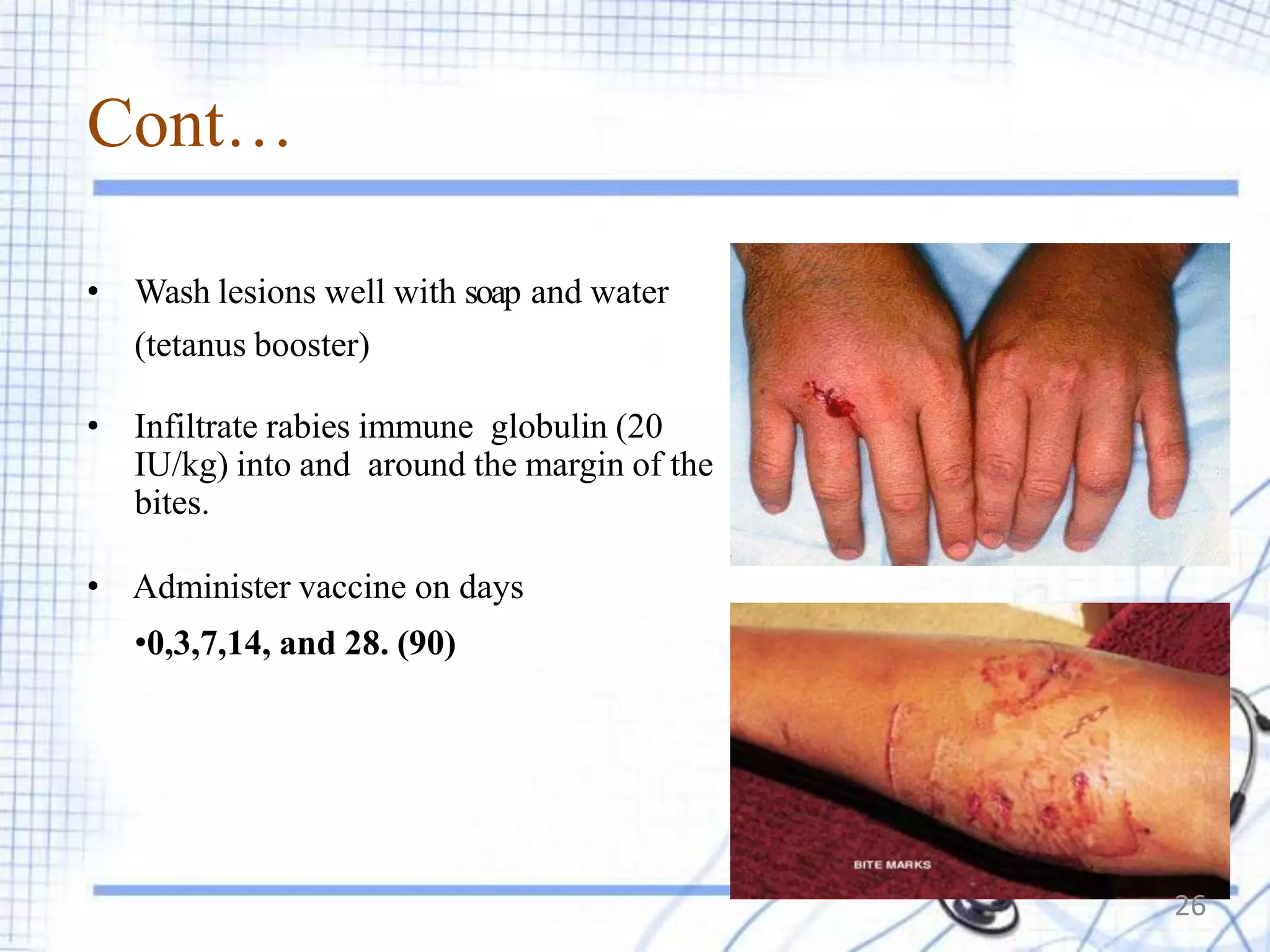 Dr.k yashoda rabies presentation | PPTX