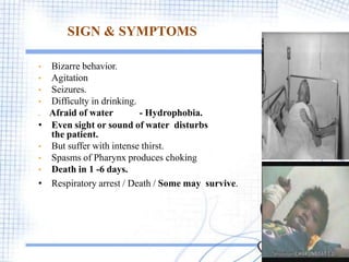 SIGN & SYMPTOMS
• Bizarre behavior.
• Agitation
• Seizures.
• Difficulty in drinking.
. Afraid of water - Hydrophobia.
• Even sight or sound of water disturbs
the patient.
• But suffer with intense thirst.
• Spasms of Pharynx produces choking
• Death in 1 -6 days.
• Respiratory arrest / Death / Some may survive.
15
 