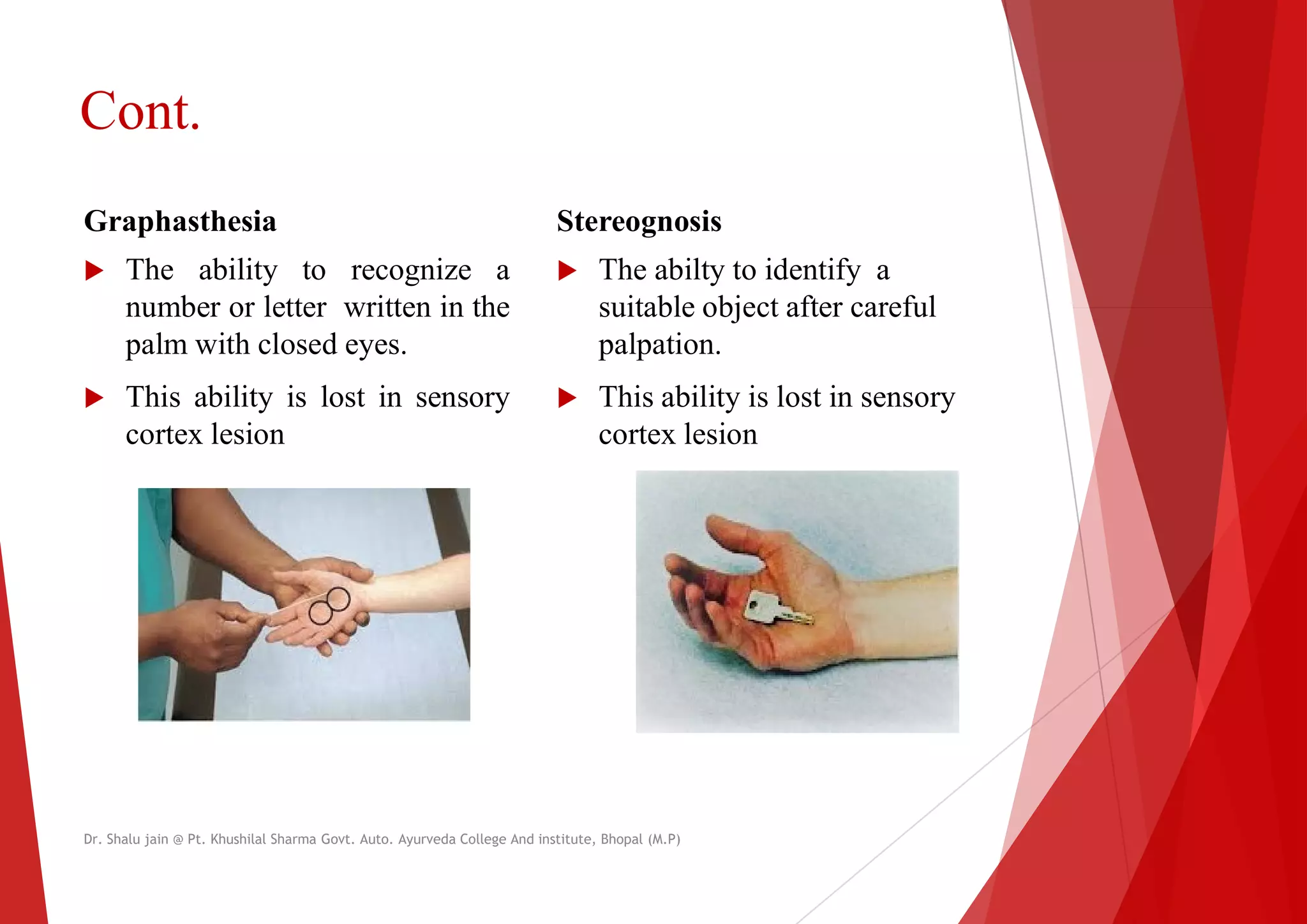 Cont.
Graphasthesia
 The ability to recognize a
number or letter written in the
Stereognosis
 The
suitable object after careful
number or letter written in the
palm with closed eyes.
 This ability is lost in sensory
cortex lesion
suitable object after careful
palpation.
 This ability is lost in sensory
cortex lesion
Dr. Shalu jain @ Pt. Khushilal Sharma Govt. Auto. Ayurveda College And institute, Bhopal (M.P)
Stereognosis
The abilty to identify a
suitable object after careful
suitable object after careful
palpation.
This ability is lost in sensory
cortex lesion
Dr. Shalu jain @ Pt. Khushilal Sharma Govt. Auto. Ayurveda College And institute, Bhopal (M.P)
 