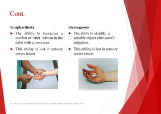 Cont.
Graphasthesia
 The ability to recognize a
number or letter written in the
Stereognosis
 The
suitable object after careful
number or letter written in the
palm with closed eyes.
 This ability is lost in sensory
cortex lesion
suitable object after careful
palpation.
 This ability is lost in sensory
cortex lesion
Dr. Shalu jain @ Pt. Khushilal Sharma Govt. Auto. Ayurveda College And institute, Bhopal (M.P)
Stereognosis
The abilty to identify a
suitable object after careful
suitable object after careful
palpation.
This ability is lost in sensory
cortex lesion
Dr. Shalu jain @ Pt. Khushilal Sharma Govt. Auto. Ayurveda College And institute, Bhopal (M.P)
 