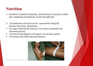 Nutrition
 Nutrition is tested by measuring circumference of muscles, at bulk
and comparing circumference of left and right
 Circumference of muscle can be measured
distance from bony prominence.
 For upper limb (arm & forearm) -10 cm above and below the
olecronon process.
 For lower limb (thigh & calf region) -16 cm above
 10 cm below the tibial tuberosity (knees)
Dr. Shalu jain @ Pt. Khushilal Sharma Govt. Auto. Ayurveda College And institute, Bhopal (M.P)
by measuring circumference of muscles, at bulk
right side.
measured by fixing the
10 cm above and below the
16 cm above patela
Dr. Shalu jain @ Pt. Khushilal Sharma Govt. Auto. Ayurveda College And institute, Bhopal (M.P)
 