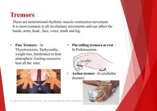 Tremors
These are unintentional rhythmic muscle contraction movement.
It is most common in all involuntary movements and can affect the
hands, arms, head , face, voice, trunk and leg.
• Fine Tremors – In
Thyrotoxicosis, Tachycardia,
weight loss, Intolerance to heat
atmosphere ,Feeling excessive
heat all the time.
• Pin rolling tremors at rest
In Parkinsonism
• Action
• Action
diseases
Dr. Shalu jain @ Pt. Khushilal Sharma Govt. Auto. Ayurveda College And institute, Bhopal (M.P)
These are unintentional rhythmic muscle contraction movement.
It is most common in all involuntary movements and can affect the
hands, arms, head , face, voice, trunk and leg.
Pin rolling tremors at rest –
In Parkinsonism
Action tremor - In cerebellar
Action tremor - In cerebellar
diseases
Dr. Shalu jain @ Pt. Khushilal Sharma Govt. Auto. Ayurveda College And institute, Bhopal (M.P)
 