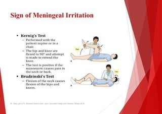 Sign of Meningeal Irritation
Dr. Shalu jain @ Pt. Khushilal Sharma Govt. Auto. Ayurveda College And institute, Bhopal (M.P)
Irritation
Dr. Shalu jain @ Pt. Khushilal Sharma Govt. Auto. Ayurveda College And institute, Bhopal (M.P)
 