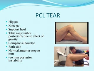 Pcl 90 R Dr. Aditya shrimal sir ppt knee examination | PPTX