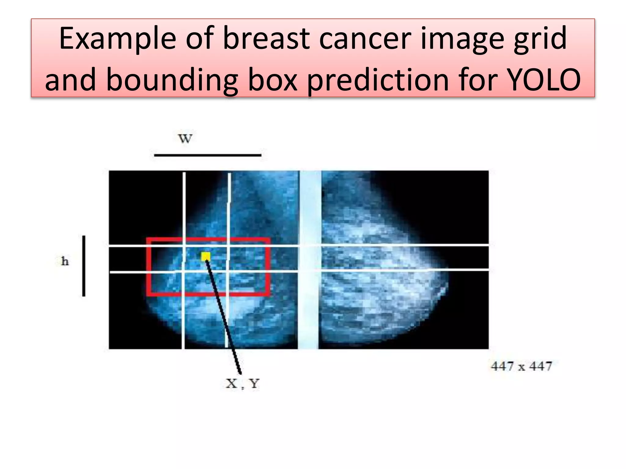 Example of breast cancer image grid
and bounding box prediction for YOLO
 