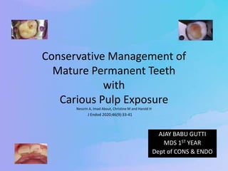 Conservative Management of
Mature Permanent Teeth
with
Carious Pulp Exposure
Nessrin A, Imad About, Christine M and Harold H
AJAY BABU GUTTI
MDS 1ST YEAR
Dept of CONS & ENDO
J Endod 2020;46(9):33-41
 