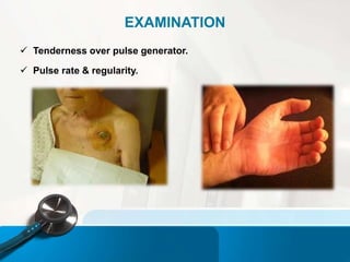 PACEMAKER by Dr.Sravani Vishnubhatla | PPTX