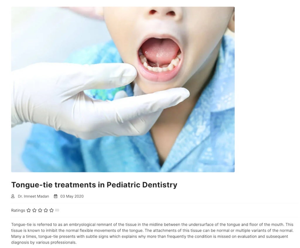 Tonguetie treatments in Pediatric Dentistry