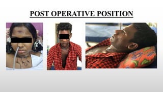 POST OPERATIVE POSITION
 