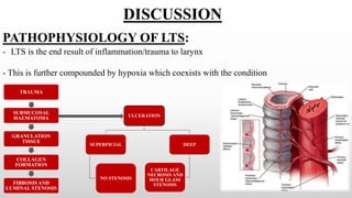 PATHOPHYSIOLOGY OF LTS:
TRAUMA
SUBMUCOSAL
HAEMATOMA
GRANULATION
TISSUE
COLLAGEN
FORMATION
FIBROSIS AND
LUMINAL STENOSIS
ULCERATION
SUPERFICIAL
NO STENOSIS
DEEP
CARTILAGE
NECROSIS AND
HOUR GLASS
STENOSIS
- LTS is the end result of inflammation/trauma to larynx
- This is further compounded by hypoxia which coexists with the condition
DISCUSSION
 