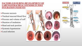 FACTORS FAVOURING DEVELOPMENT OF
LARYNGOTRACHEAL STENOSIS IN POST
INTUBATION PATIENTS
Pressure necrosis
Tracheal mucosal blood flow
Pressure and volume of cuff
Duration of intubation
Head and neck position
Systemic hypotension
Local infection
 
