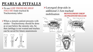 PEARLS & PITFALLS
To use LOW PRESSURE HIGH
VOLUME Endo tracheal &
Tracheostomy tubes
When a stenotic patient presents with
stridor –Tracheostomy should be done
at or just below the stenotic site, So
that cartilage is not wasted and trachea
can be saved for future anastomosis
Laryngeal drop-aids in
additional 2-3cm tracheal
mobilisation MONTGOMERY DROP
/SUPRAHYOID RELEASE
 