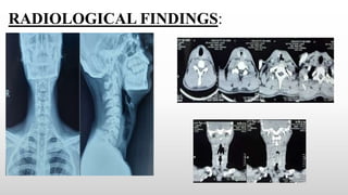 RADIOLOGICAL FINDINGS:
 