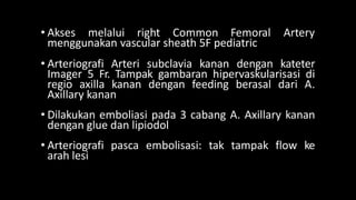 Embolisasi dr. Nani PPT (Kasus) Embolisasi pada Infantil Hemangioma (1).pptx