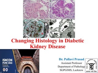 Changing Histology in Diabetic
Kidney Disease
Dr. Pallavi Prasad
Assistant Professor
Department of Pathology
SGPGIMS, Lucknow
 
